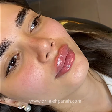 بهترین دکتر تزریق ژل در ستارخان