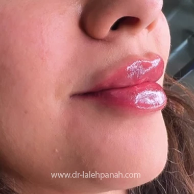 دکتر تزریق ژل در ستارخان