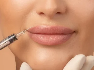 مراحل تزریق ژل لب
