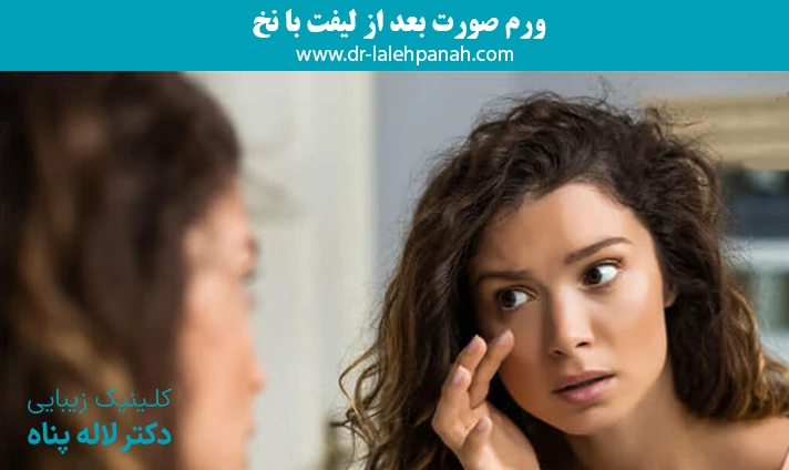 ورم صورت بعد از لیفت با نخ