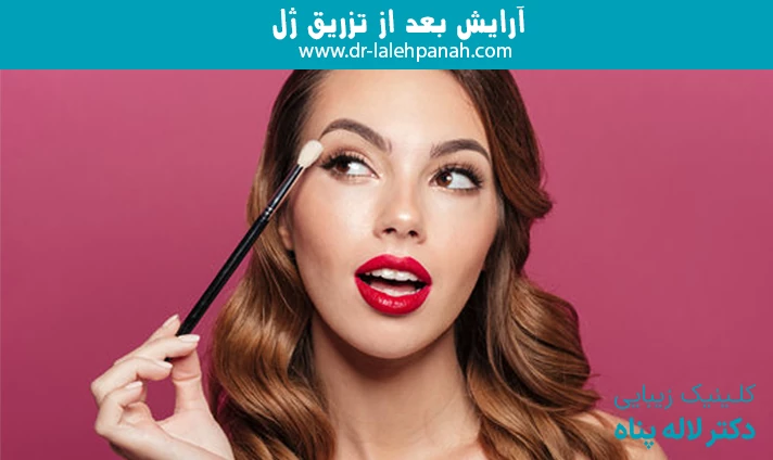آرایش بعد از تزریق ژل