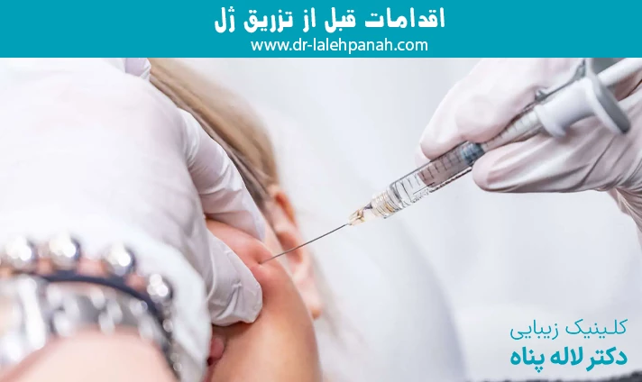 اقدامات قبل از تزریق ژل