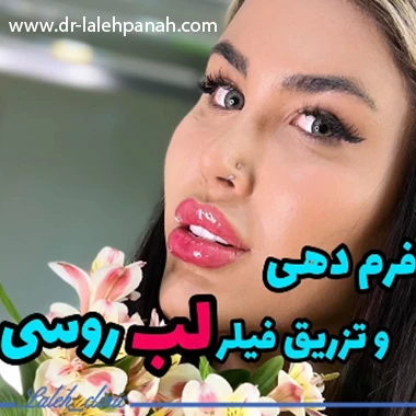 قبل و بعد تزریق ژل