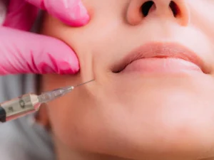 مزایای تزریق ژل خط خنده