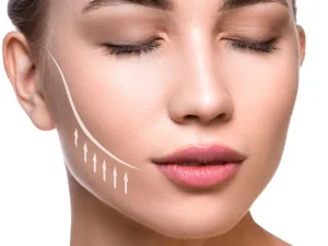 مزایای تزریق ژل گونه