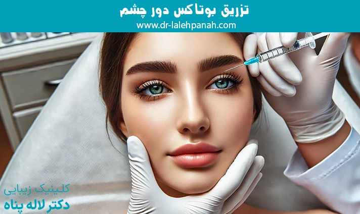 تزریق بوتاکس دور چشم