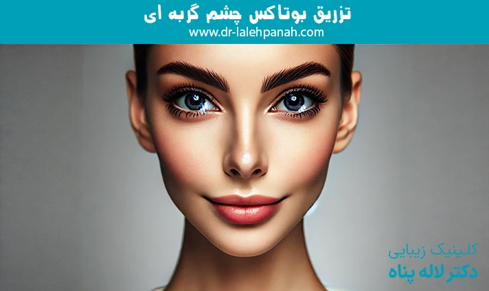 تزریق بوتاکس چشم گربه ای
