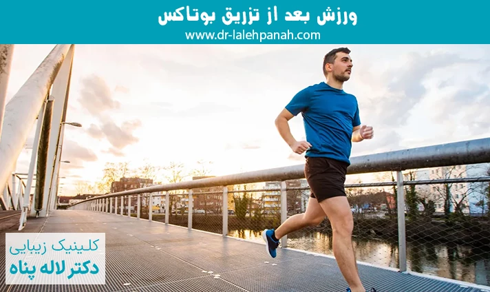ورزش بعد از تزریق بوتاکس