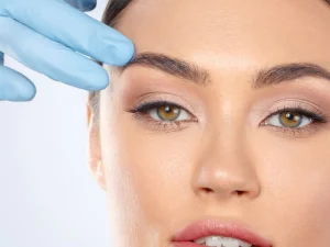 عکس لیفت شقیقه با بوتاکس
