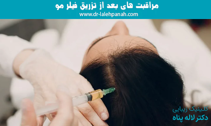 مراقبت های بعد از تزریق فیلر مو