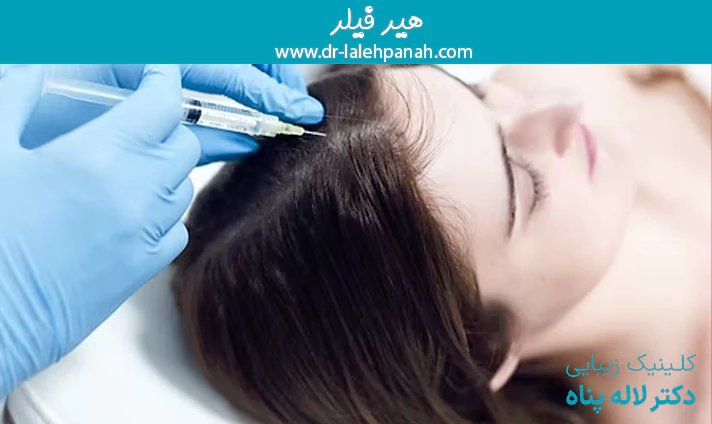 هیرفیلر