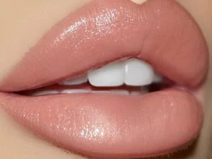 تزریق ژل لب مدل عروسکی