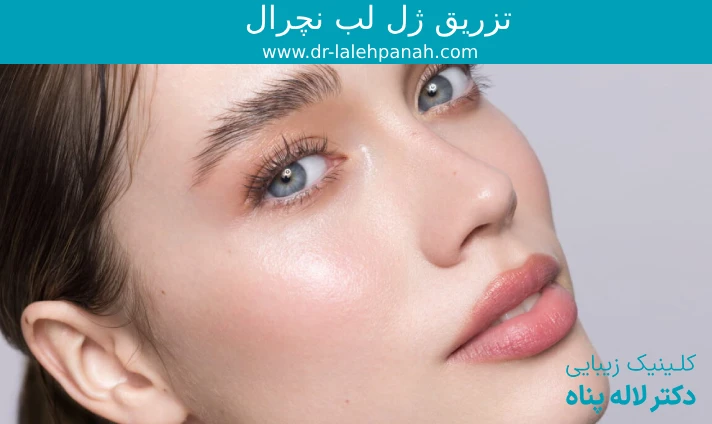 تزریق ژل لب نچرال